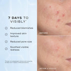 Niacinamide peptides